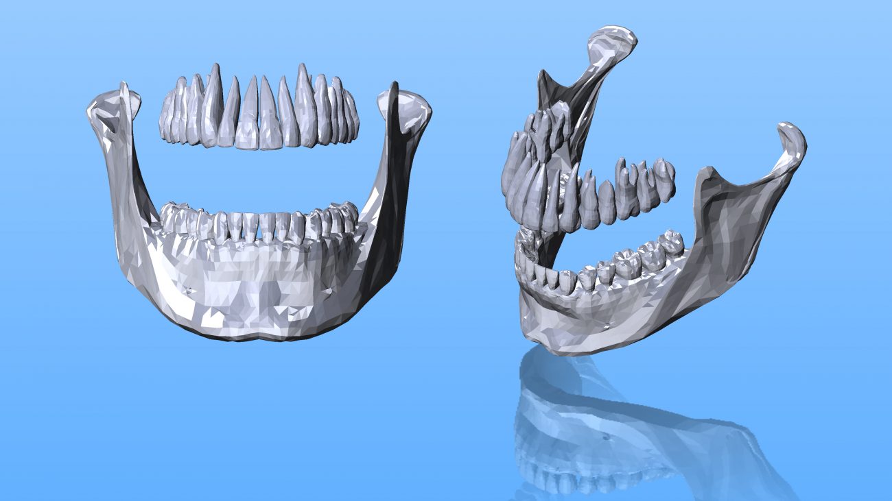 Lower_Jaw_White-1300x731 Assessing Potential, Reducing the Risk<br />
Pairing experience and expertise to make confident decisions