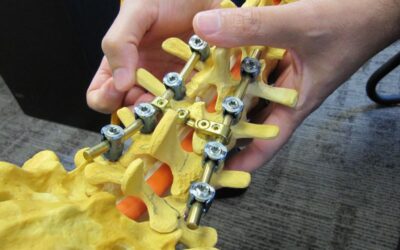 Pedicle Screw System