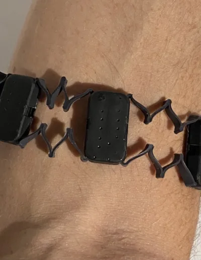 IBT Armband prototype assembled and worn on the forearm