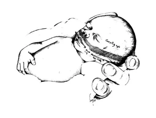 cpap cannula for premature babies