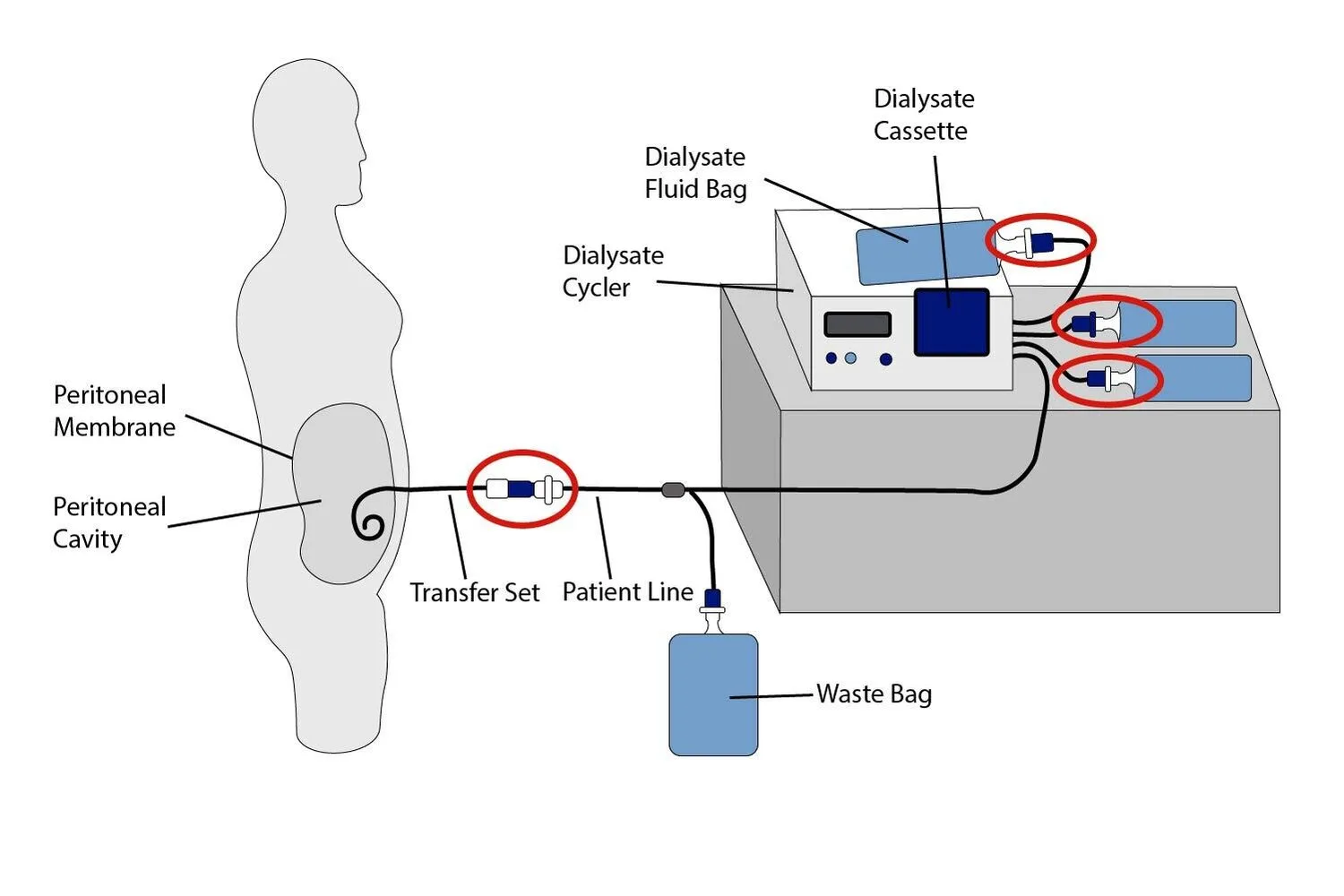 disinfecting dialysis tubing